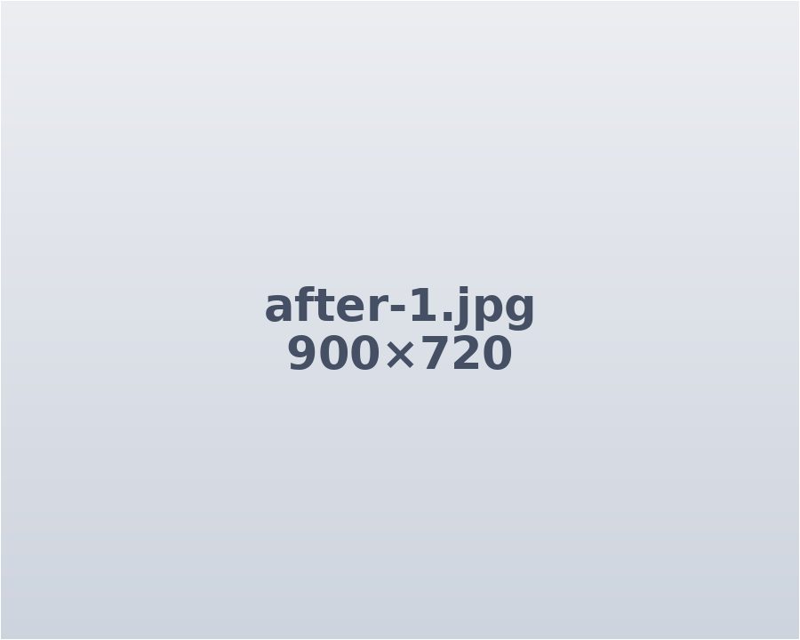 After treatment