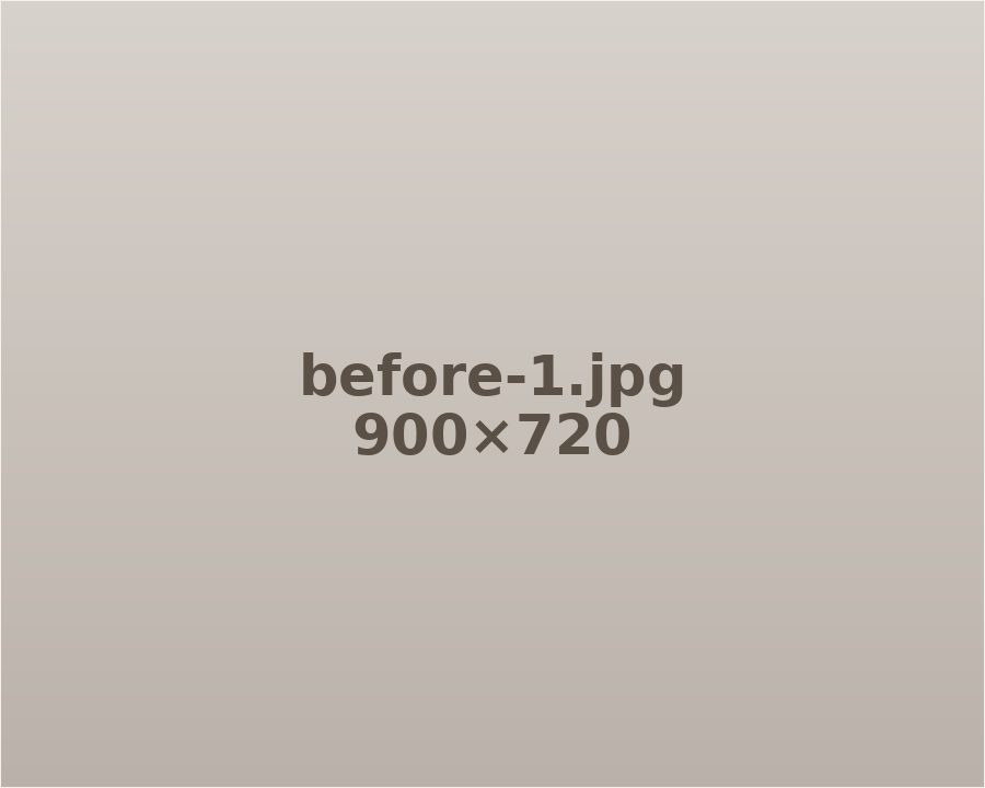 Before treatment