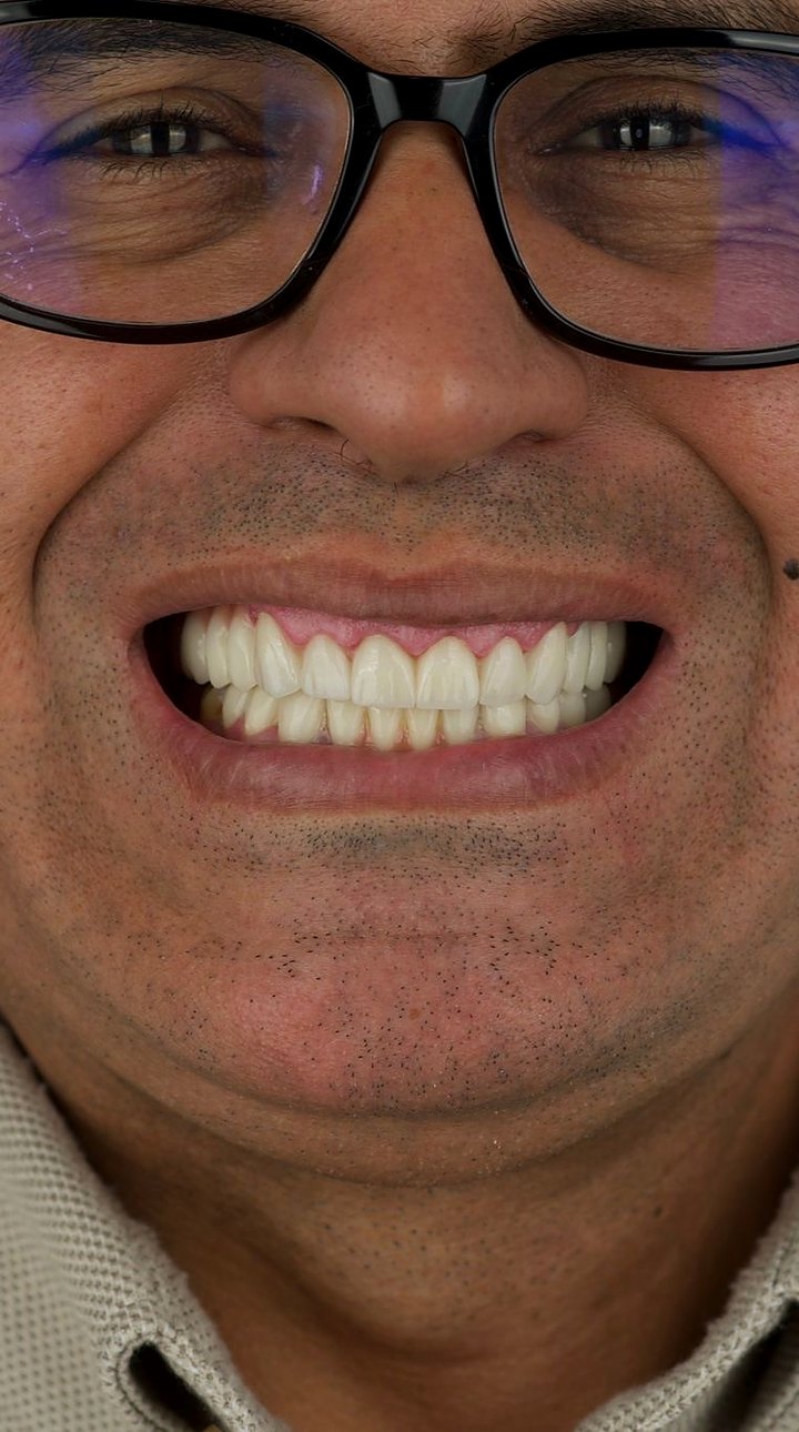 Patient A after treatment