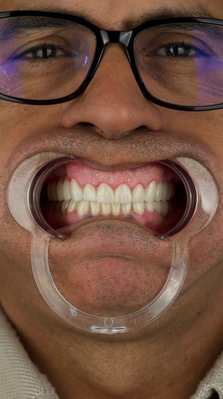 Patient A after treatment