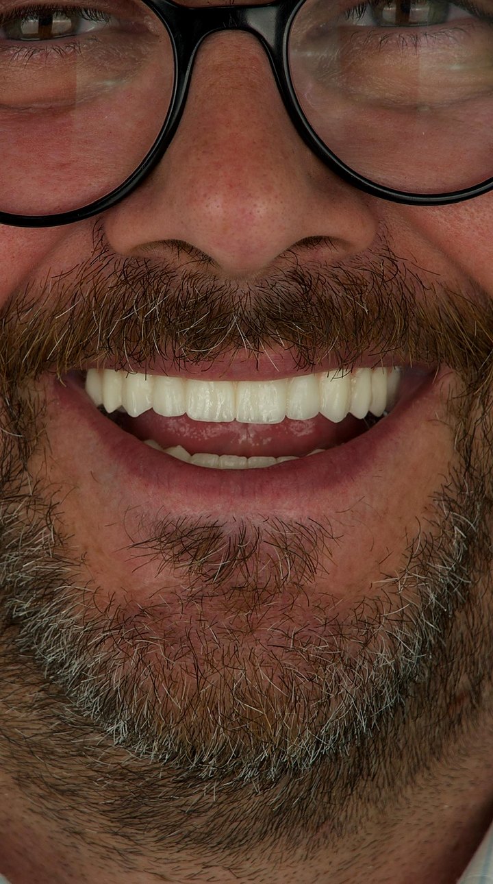 Patient B after treatment