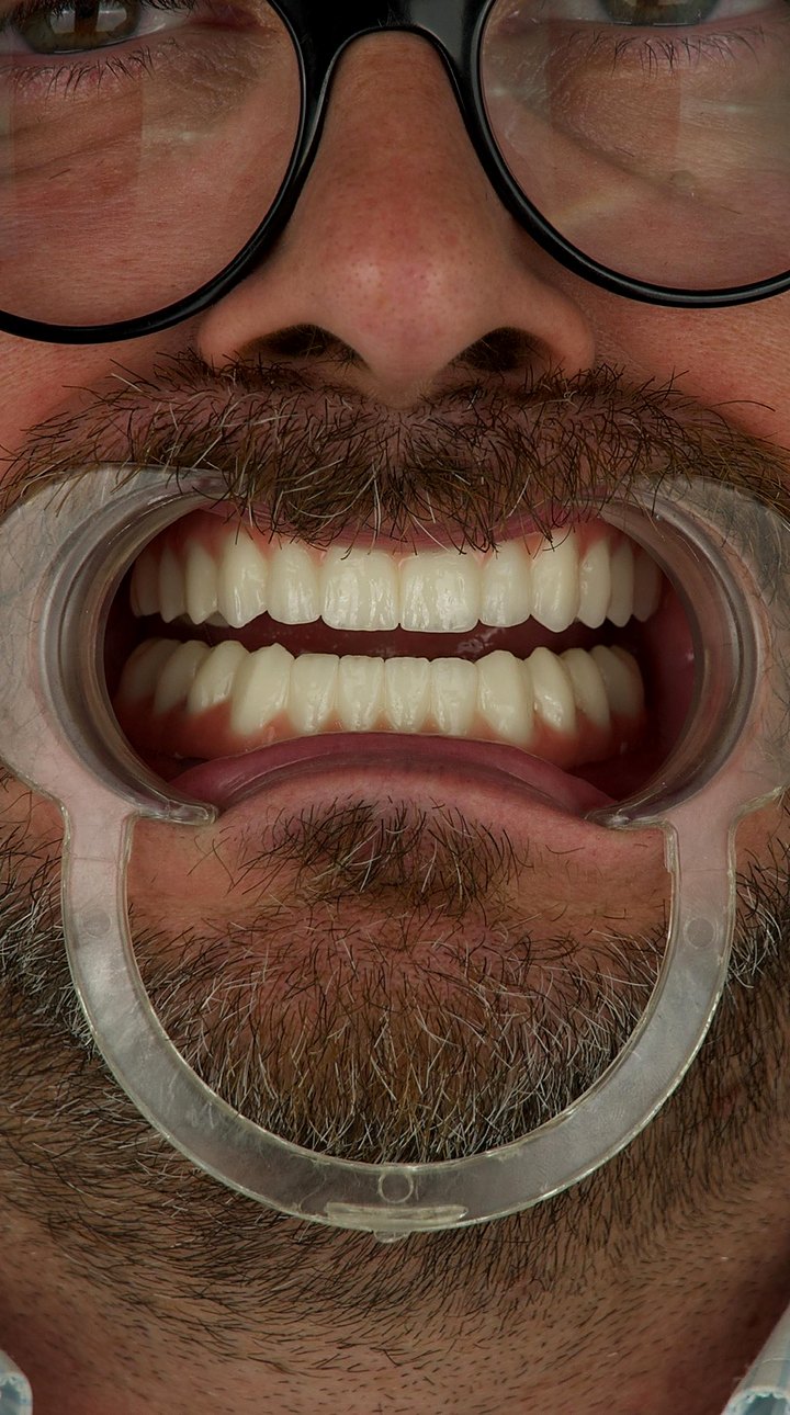 Patient B after treatment