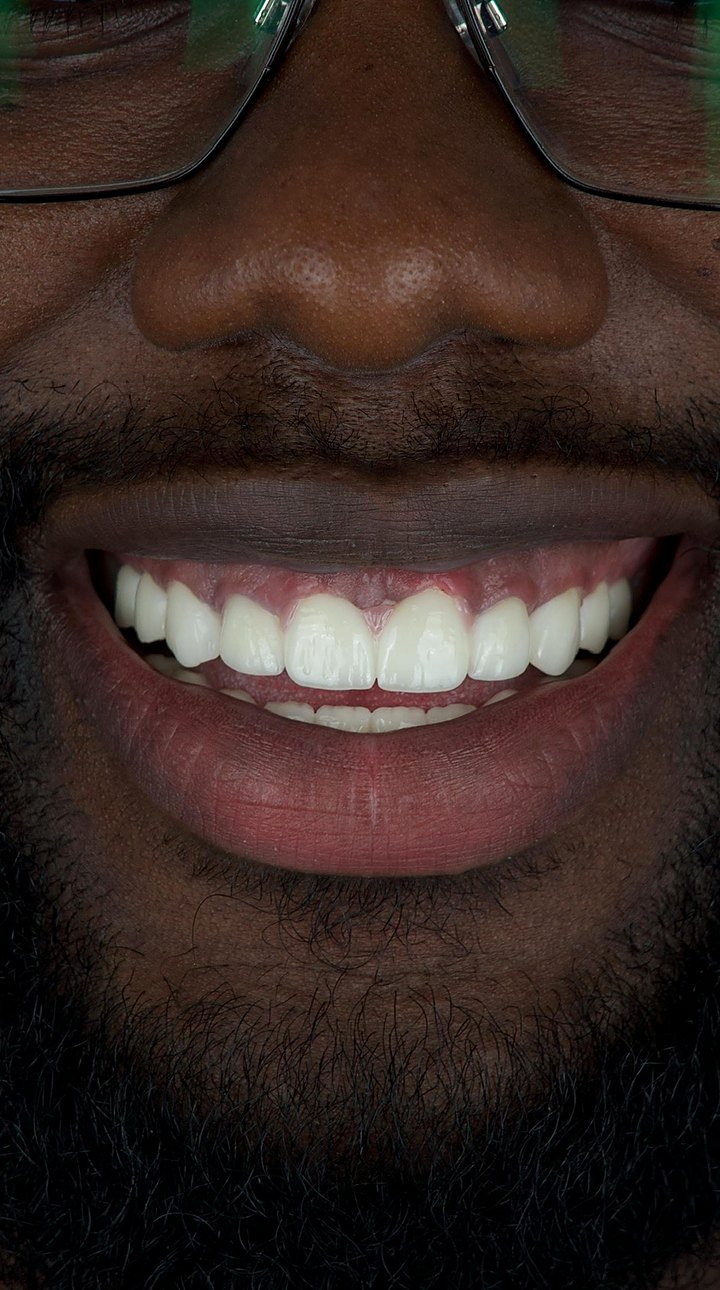 Patient C after treatment