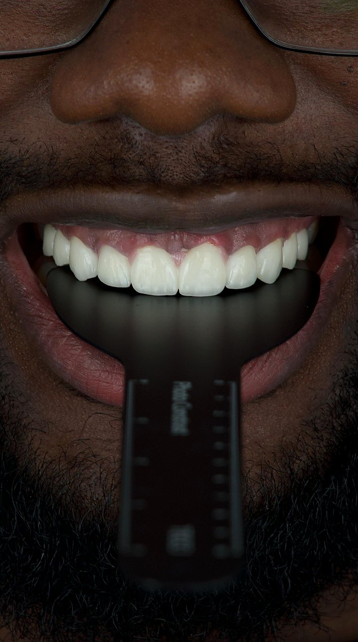 Patient C after treatment