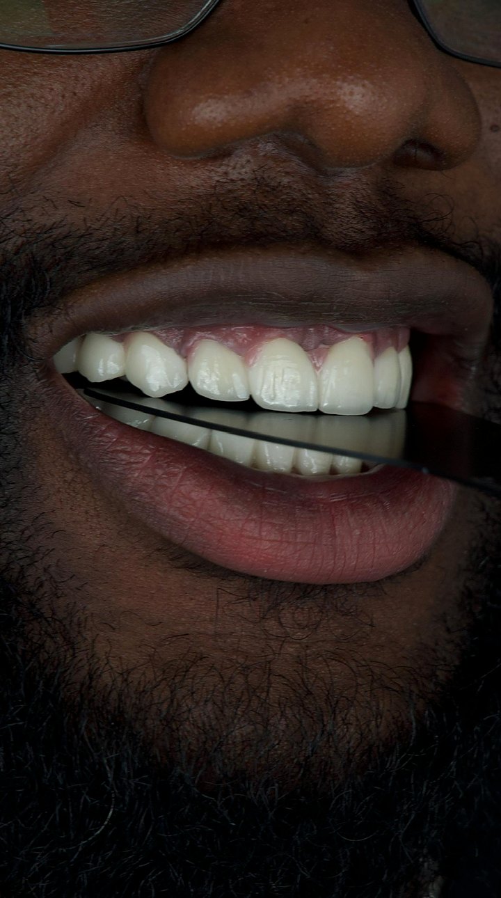Patient C after treatment