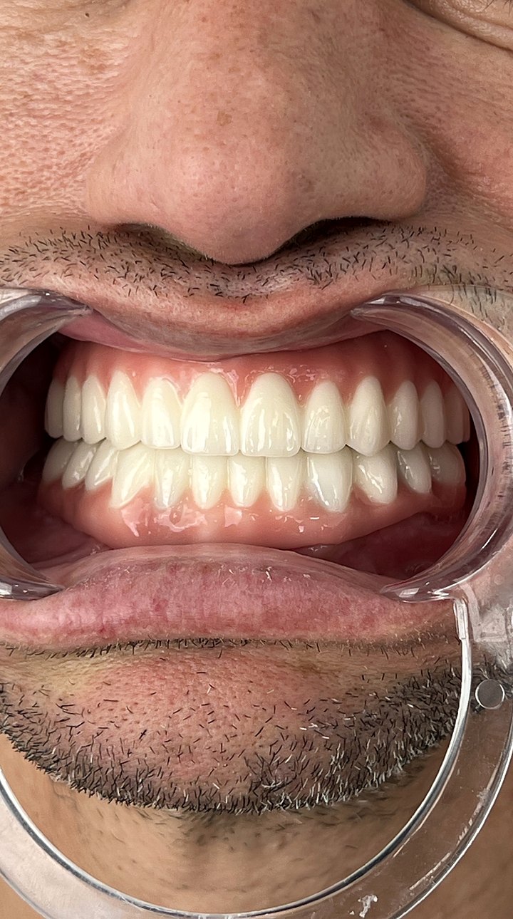 Patient D after treatment