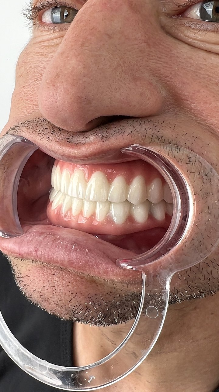 Patient D after treatment